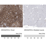 ARHGAP30 Antibody in Immunohistochemistry (Paraffin) (IHC (P))