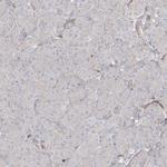 ARHGAP30 Antibody in Immunohistochemistry (Paraffin) (IHC (P))