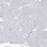 ARHGAP30 Antibody in Immunohistochemistry (Paraffin) (IHC (P))