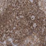 ARHGAP30 Antibody in Immunohistochemistry (Paraffin) (IHC (P))