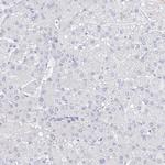 VSIG1 Antibody in Immunohistochemistry (Paraffin) (IHC (P))