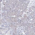 VSIG1 Antibody in Immunohistochemistry (Paraffin) (IHC (P))