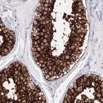 VSIG1 Antibody in Immunohistochemistry (Paraffin) (IHC (P))