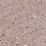 GNL3L Antibody in Immunohistochemistry (Paraffin) (IHC (P))