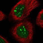 HOMEZ Antibody in Immunocytochemistry (ICC/IF)