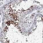 HOMEZ Antibody in Immunohistochemistry (Paraffin) (IHC (P))