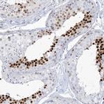 HOMEZ Polyclonal Antibody