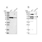 HOMEZ Antibody in Western Blot (WB)