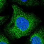 UBXD2 Polyclonal Antibody