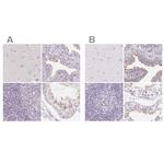 ZBBX Polyclonal Antibody