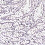 ZBBX Antibody in Immunohistochemistry (IHC)