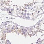 ZBBX Antibody in Immunohistochemistry (IHC)
