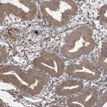 ABCF3 Antibody in Immunohistochemistry (Paraffin) (IHC (P))