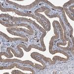 ABCF3 Antibody in Immunohistochemistry (Paraffin) (IHC (P))