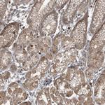 ABCF3 Antibody in Immunohistochemistry (Paraffin) (IHC (P))