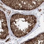 ABCF3 Antibody in Immunohistochemistry (Paraffin) (IHC (P))