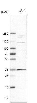 ELOVL7 Antibody in Western Blot (WB)