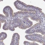 TTC26 Antibody in Immunohistochemistry (IHC)
