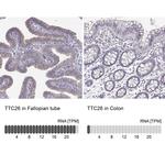 TTC26 Antibody