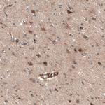 CAMTA1 Polyclonal Antibody