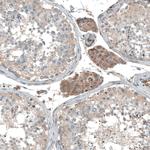 CAMTA1 Antibody in Immunohistochemistry (Paraffin) (IHC (P))
