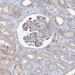CAMTA1 Antibody in Immunohistochemistry (IHC)