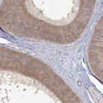CAMTA1 Antibody in Immunohistochemistry (IHC)