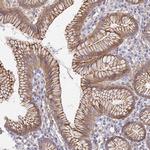 CCDC30 Polyclonal Antibody