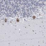 CU070 Antibody in Immunohistochemistry (Paraffin) (IHC (P))