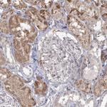 LACTB Antibody in Immunohistochemistry (Paraffin) (IHC (P))