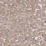 LACTB Antibody in Immunohistochemistry (Paraffin) (IHC (P))