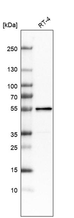 LACTB Antibody in Western Blot (WB)