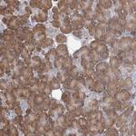 LACTB Antibody in Immunohistochemistry (IHC)