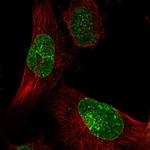 KIAA1586 Polyclonal Antibody