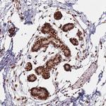 SPT6 Antibody in Immunohistochemistry (Paraffin) (IHC (P))