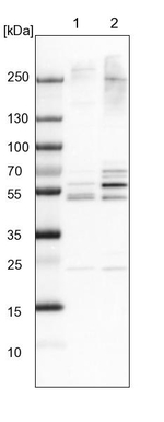 WDR12 Antibody in Western Blot (WB)