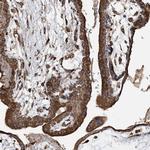 WDR12 Polyclonal Antibody