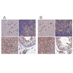 DNPEP Polyclonal Antibody