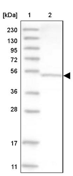 DNPEP Antibody in Western Blot (WB)