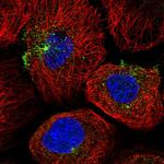 RAB11FIP5 Polyclonal Antibody