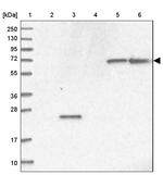 RAB11FIP5 Antibody in Western Blot (WB)