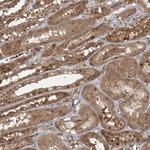 FBXL17 Antibody in Immunohistochemistry (Paraffin) (IHC (P))