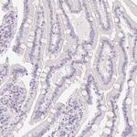 MORC1 Antibody in Immunohistochemistry (Paraffin) (IHC (P))
