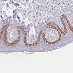 MORC1 Antibody in Immunohistochemistry (Paraffin) (IHC (P))