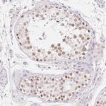MORC1 Antibody in Immunohistochemistry (Paraffin) (IHC (P))