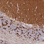 SNED1 Antibody in Immunohistochemistry (Paraffin) (IHC (P))