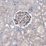 SNED1 Antibody in Immunohistochemistry (Paraffin) (IHC (P))