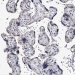 SNED1 Antibody in Immunohistochemistry (Paraffin) (IHC (P))