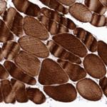 SNED1 Antibody in Immunohistochemistry (Paraffin) (IHC (P))