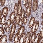 SNED1 Polyclonal Antibody